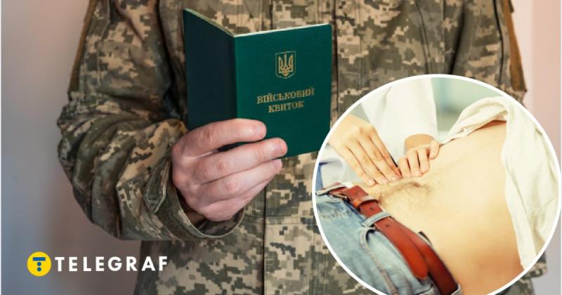 Чи призвуть до армії з паховою грижею: захворювання, що звільняють від мобілізації